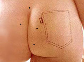 身體上哪些痣是好運(yùn)痣